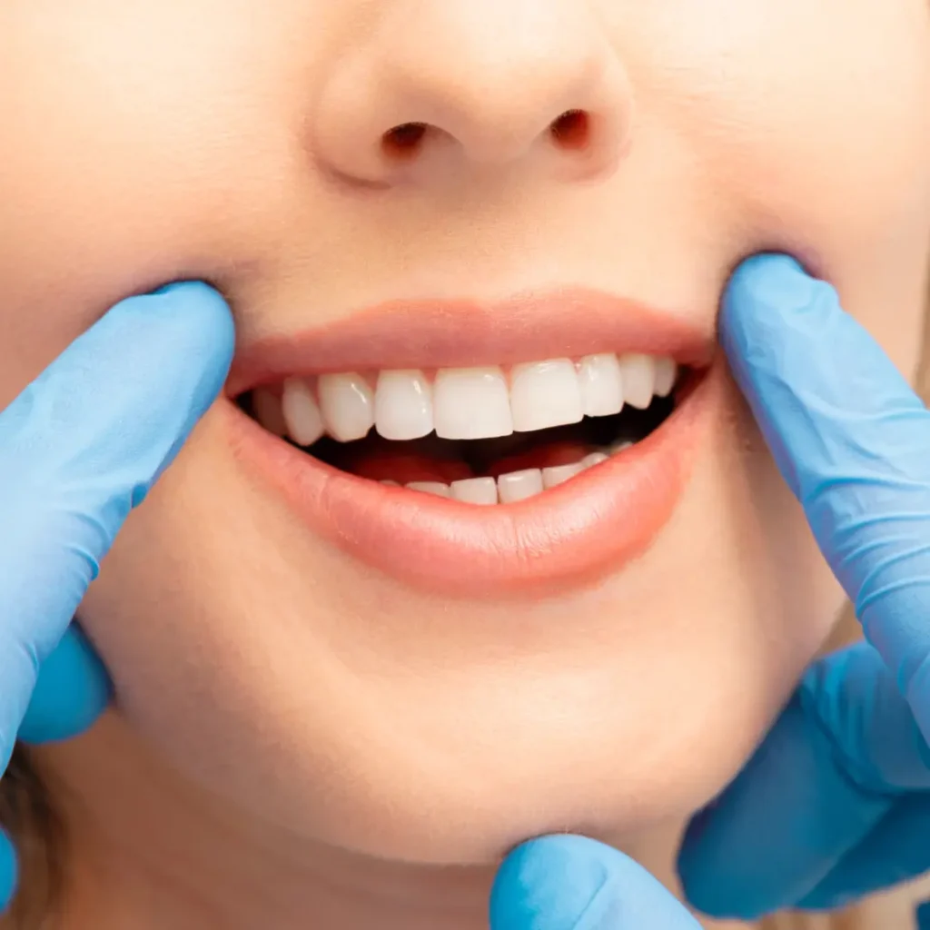 Best Teeth Whitening Service