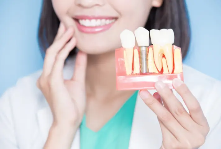 Dentist in HSR layout for Dental Implant