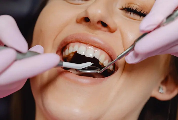 Root Canal Treatment HSR layout