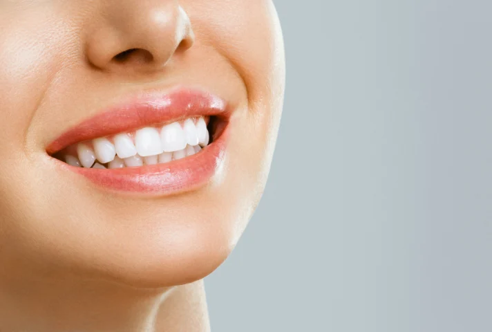 Teeth Whitening - Dream Smilez