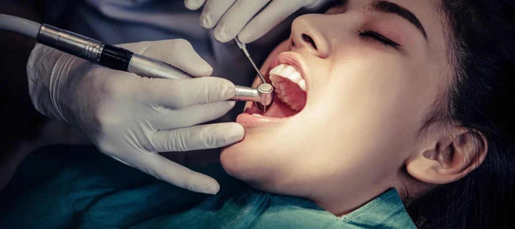 Dental filling treatment in HSR layout